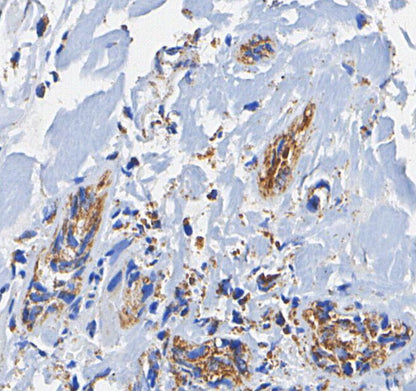 PDI Antibody