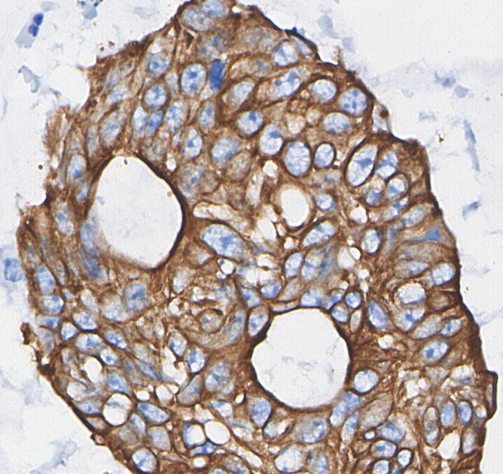 Phospho-HER2/ErbB2 (Tyr1221/1222) Antibody