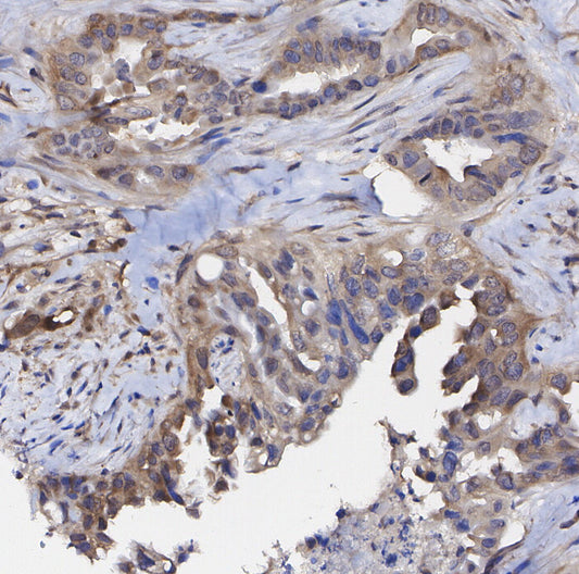 Rictor Antibody