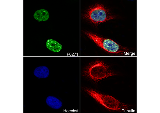 Acetyl-Histone H3 (Lys27) Antibody