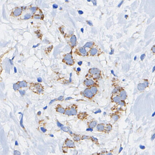 LC3A Antibody