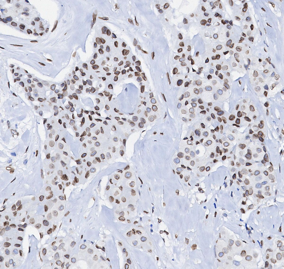 Lamin A/C Antibody