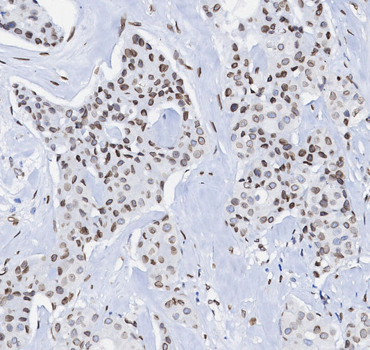 Lamin A/C Antibody