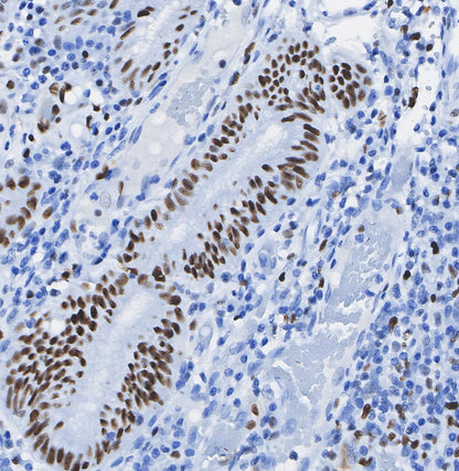 Phospho-Rb (Ser807/811) Antibody