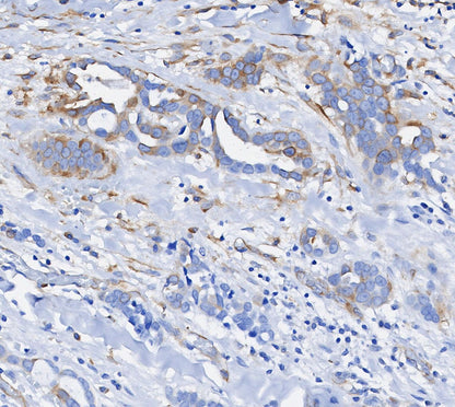 Phospho-S6 Ribosomal Protein (Ser240/244) Antibody