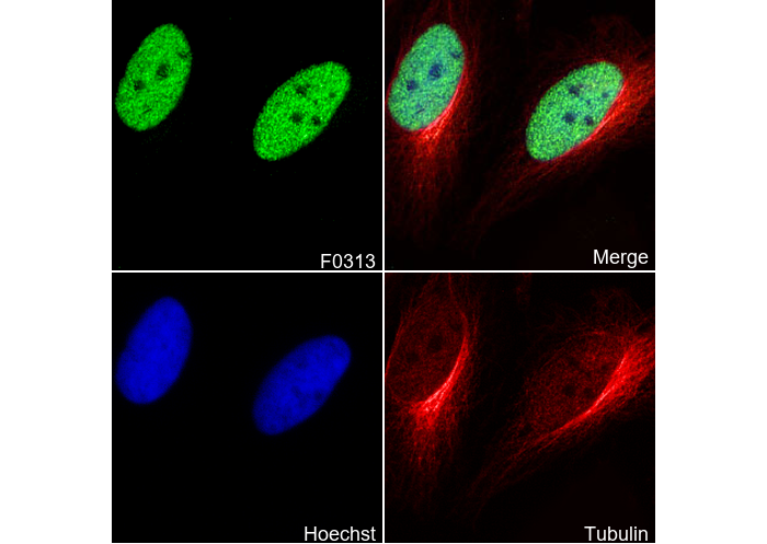 Ubiquityl-Histone H2A (Lys119) Antibody