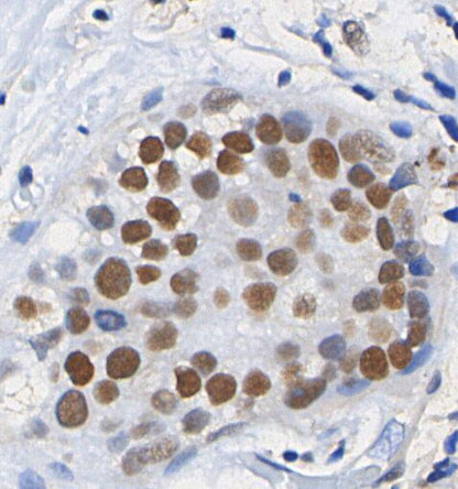 Acetyl-Histone H3 (Lys9) Antibody