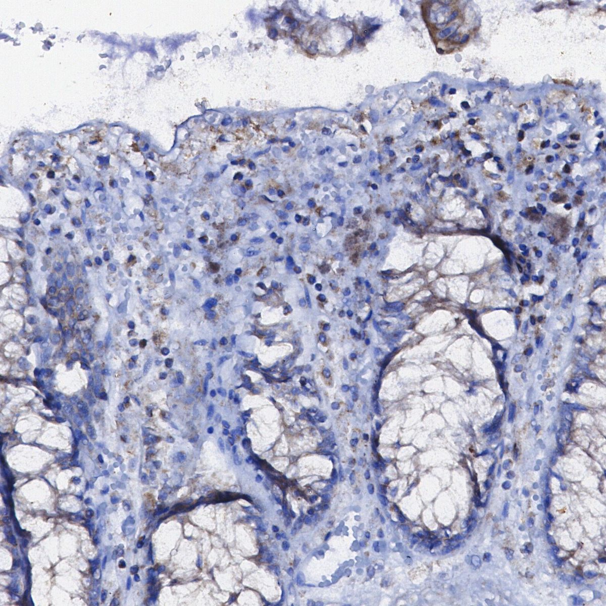 Bak Antibody