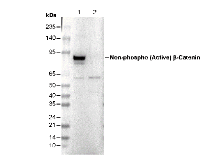 Non-phospho β-Catenin (S33/37/T41) Antibody