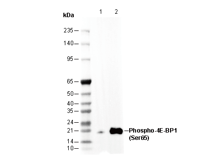 Phospho-4E-BP1 (Ser65) Antibody