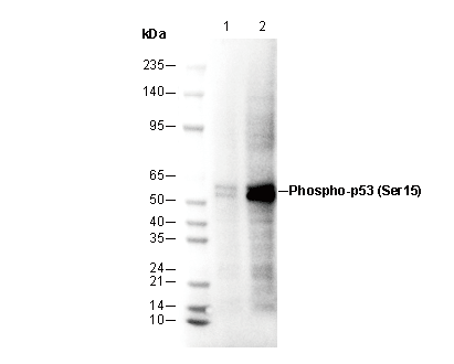 Phospho-p53 (Ser15) Antibody