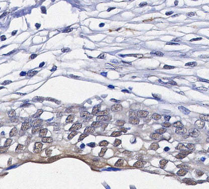 YAP Antibody