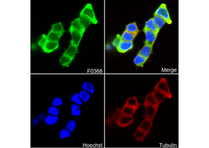 βIII-Tubulin Antibody