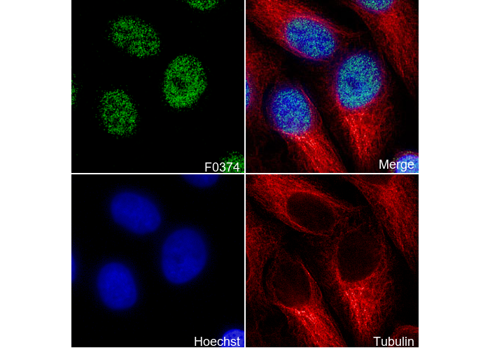 Chk2 Antibody