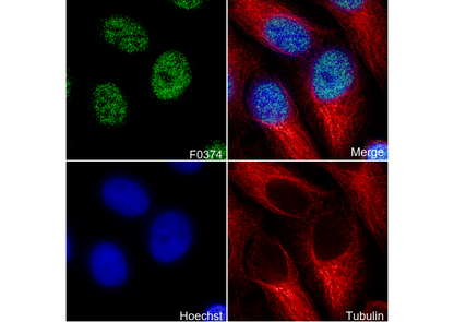 Chk2 Antibody