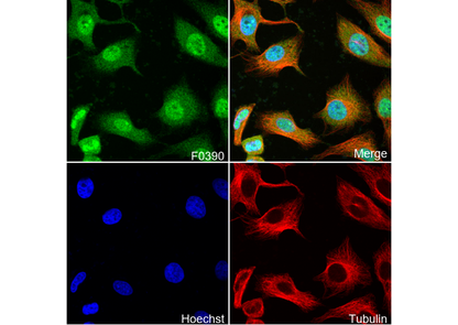 MEF2C Antibody