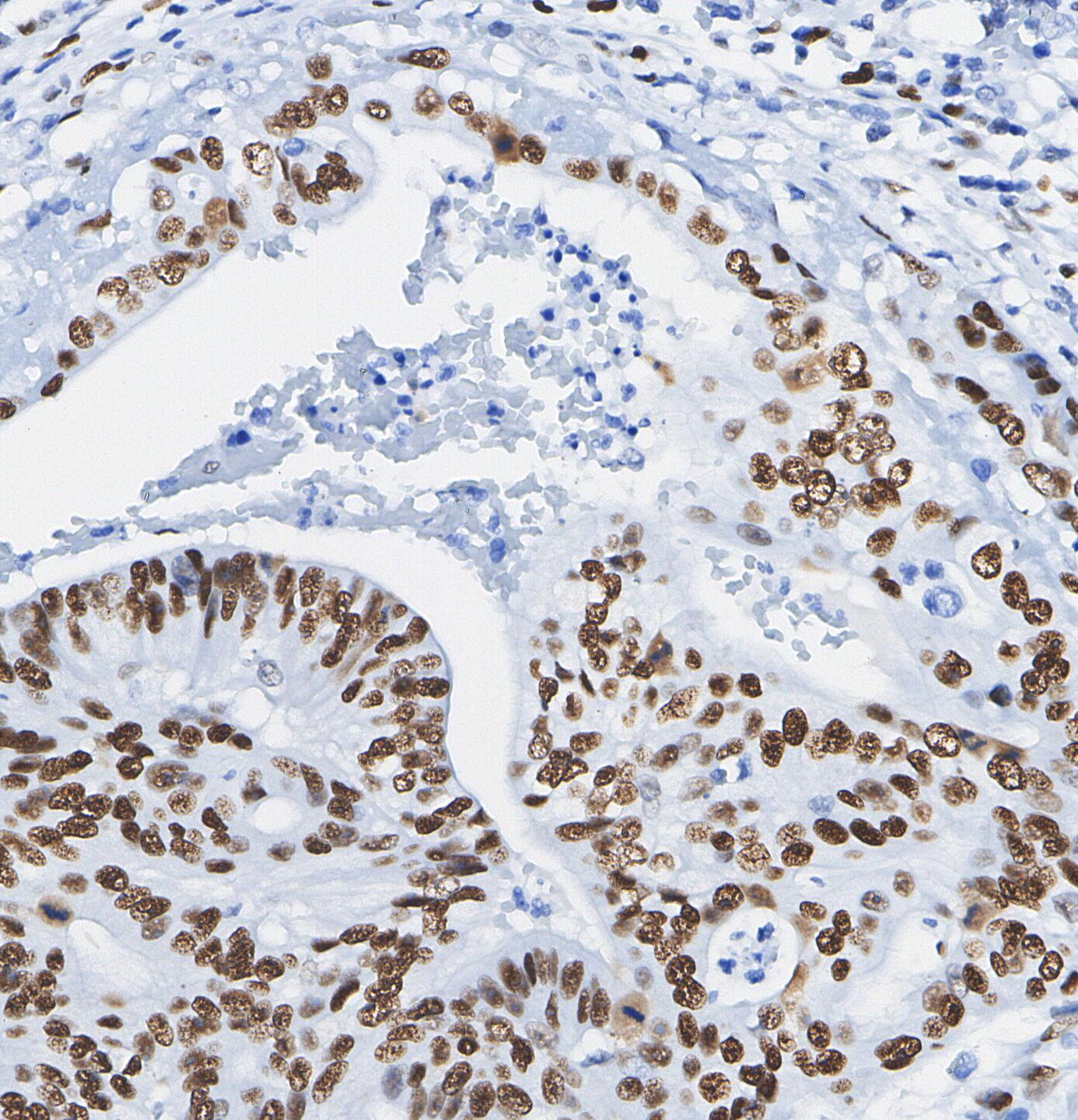PLK1 Antibody