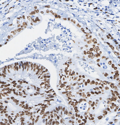 PLK1 Antibody