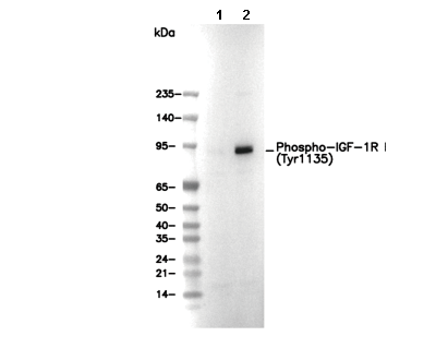 Phospho-IGF-1R β (Tyr1135) Antibody