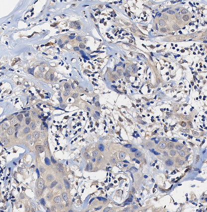 SHP2 Antibody