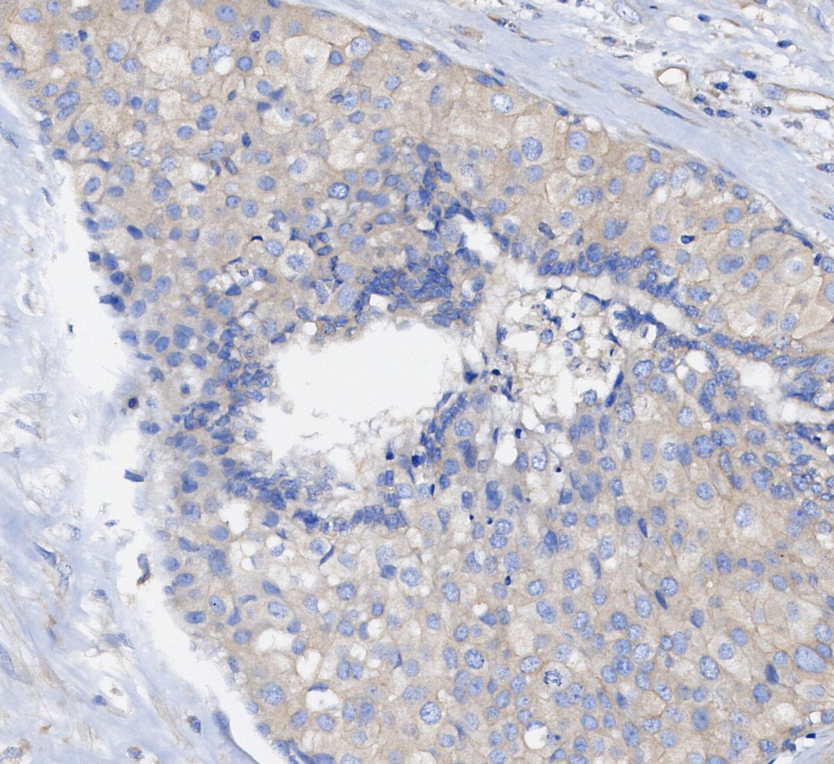 Arginase-1 Antibody