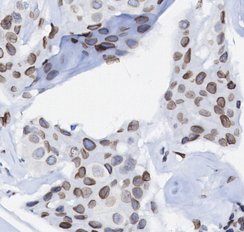 Btk Antibody