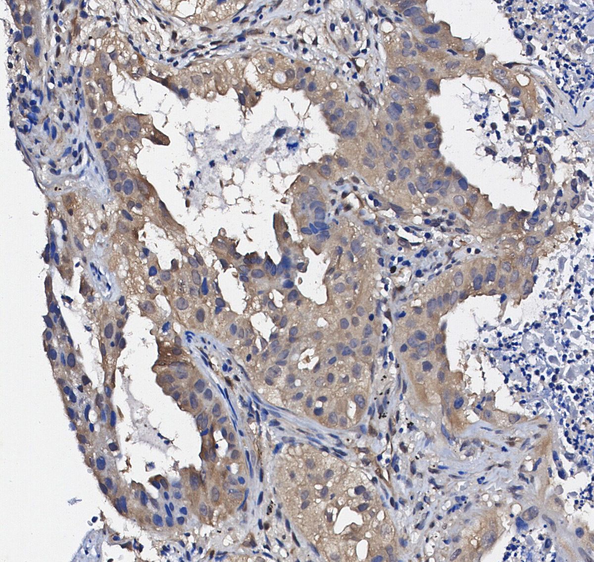 FAK Antibody