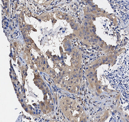 FAK Antibody