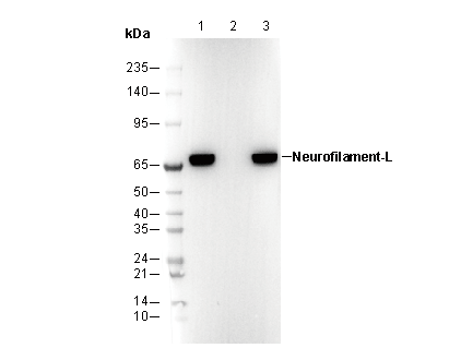 Neurofilament-L Antibody