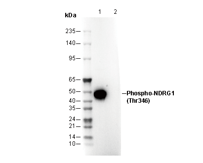 Phospho-NDRG1 (Thr346) Antibody