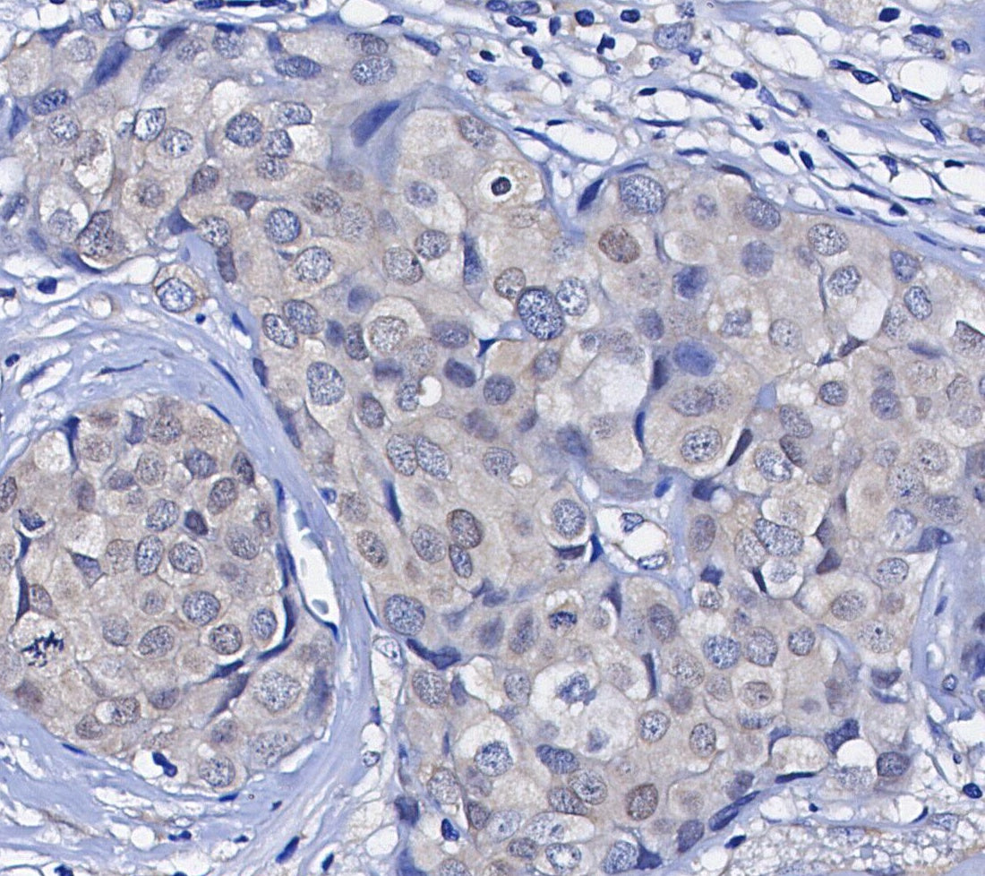 RelB Antibody