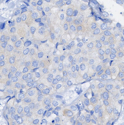 Thioredoxin 1 Antibody