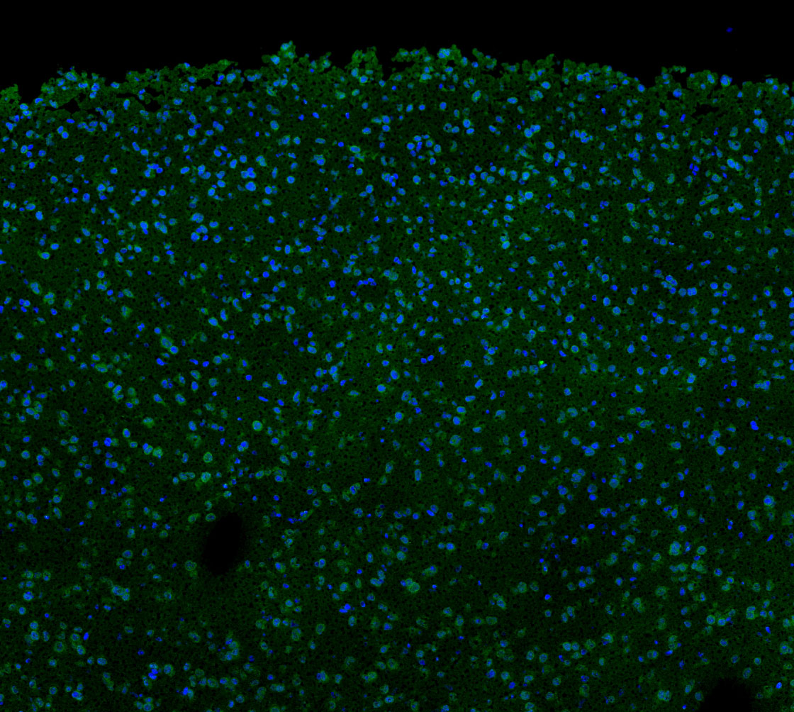 p35/25 Antibody