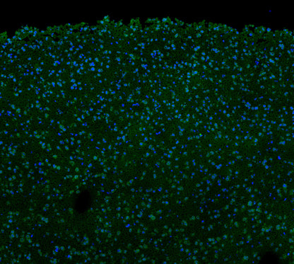 p35/25 Antibody