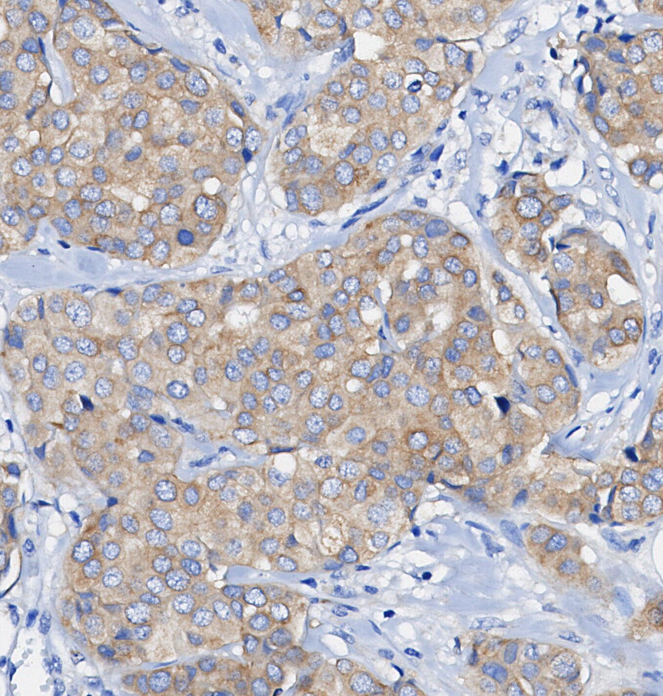 Phospho-GSK-3 (Ser21) Antibody