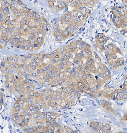 Phospho-GSK-3 (Ser21) Antibody