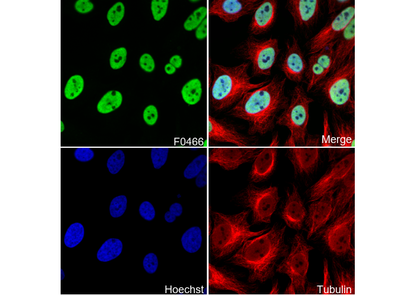 Ubiquityl-Histone H2B (Lys120) Antibody