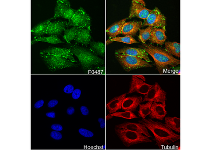 Non-phospho β-Catenin (Ser45) Antibody