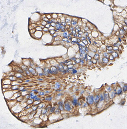 Non-phospho β-Catenin (Ser45) Antibody