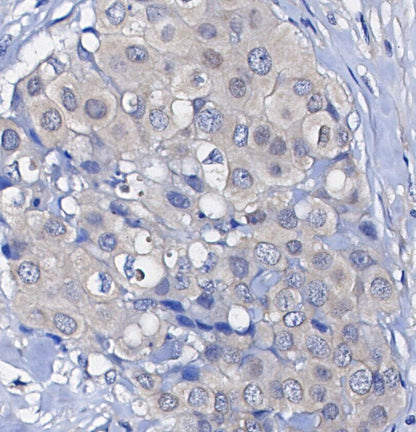 Phospho-p90RSK (Ser380) Antibody