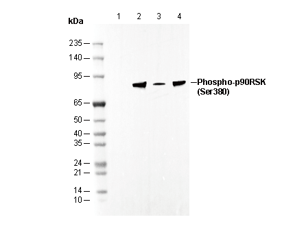 Phospho-p90RSK (Ser380) Antibody