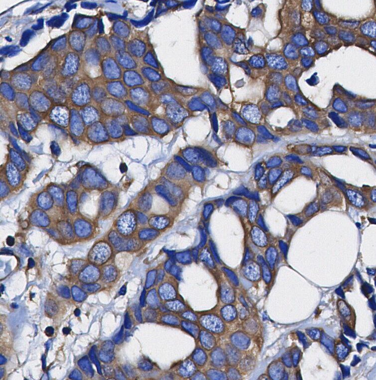 RIP3 Antibody