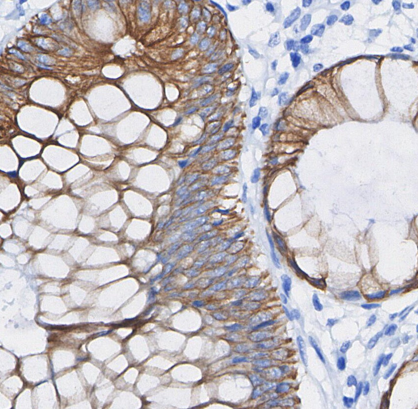 Ras Antibody