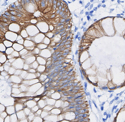 Ras Antibody