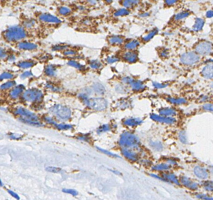 SOD2 Antibody