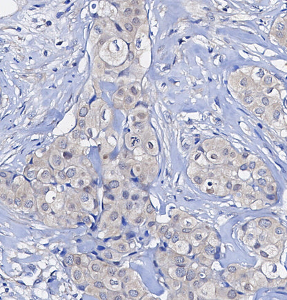 SP1 Antibody