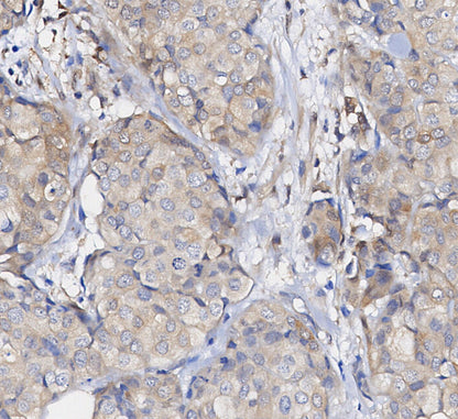 Stat5 Antibody
