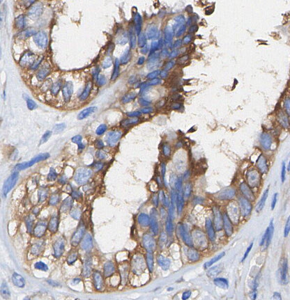 TOMM20 Antibody