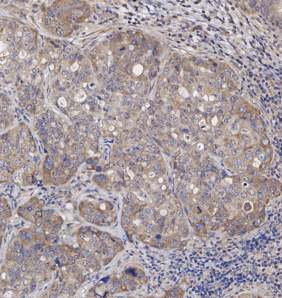 NAK/TBK1 Antibody
