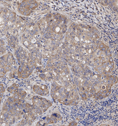 NAK/TBK1 Antibody